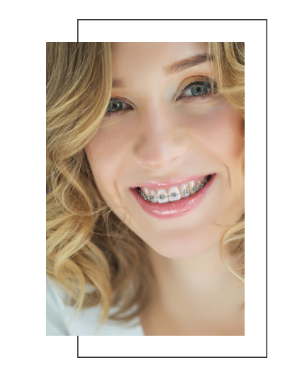 The image displays a woman with straightened teeth smiling at the camera. She has blonde hair and is wearing makeup. The background is neutral, and there are no visible texts on the image.